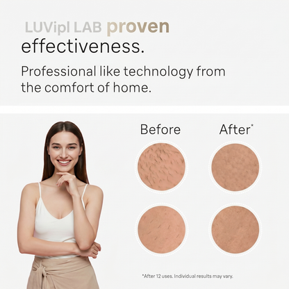 LUVipl EVO Expert 9900